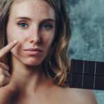 Acne diet