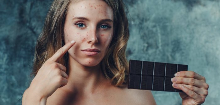 Acne diet
