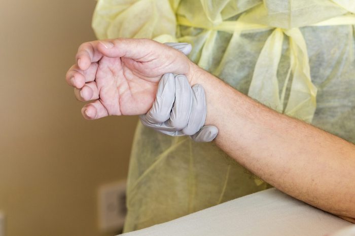 Hand arthritis treatment